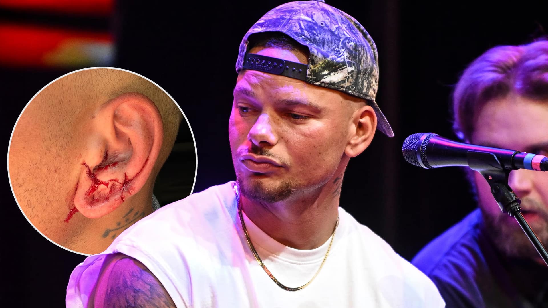 Kane Brown showing the 23 stitches near his ear after a golf ball struck him in the head during a round in Nashville.